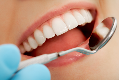 How to Prepare for Teeth Whitening